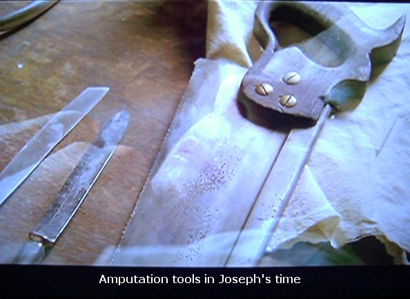 Joseph Smith surgerical tools used on his leg.
